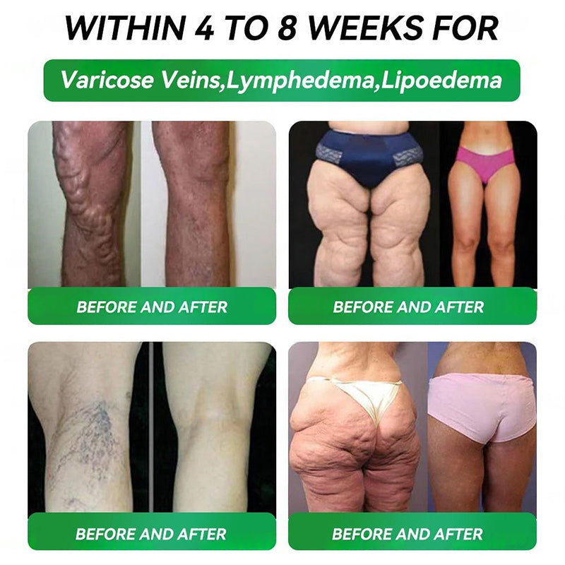 Last day 50%OFF š„Official StorešNATRAVORĀ®10-in-1 Multi-Functional Vitality Oral Solutionš©āā¤ļøāšØ(Just once a day,visible changes in 7 days)ā
For obesity,cardiovascular health,diabetes,sleep apnea,Gut Health,joint issues,and more